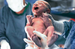 In a first, baby born with antibodies after mother vaccinated: Doctors