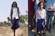 Bihar girl who hopped to school on one leg gets artificial limb