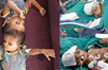 1 Of Odisha twins separated through India’s first Craniopagus Surgery dies