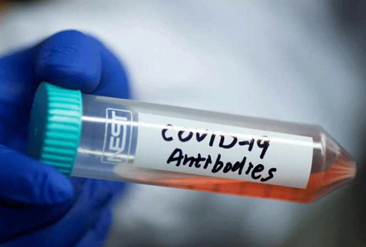 Advisory on Antigen detection test for COVID-19 issued by ICMR