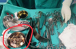 Karnataka doctors remove 187 coins from schizophrenia patients stomach